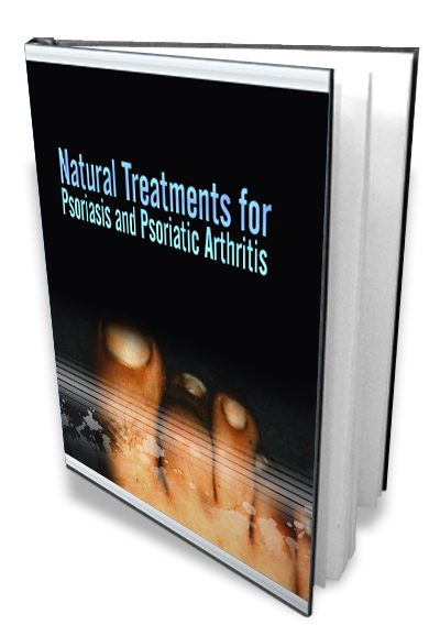 Now Age Books - Natural Treatments for Psoriasis - nowagebooks.com